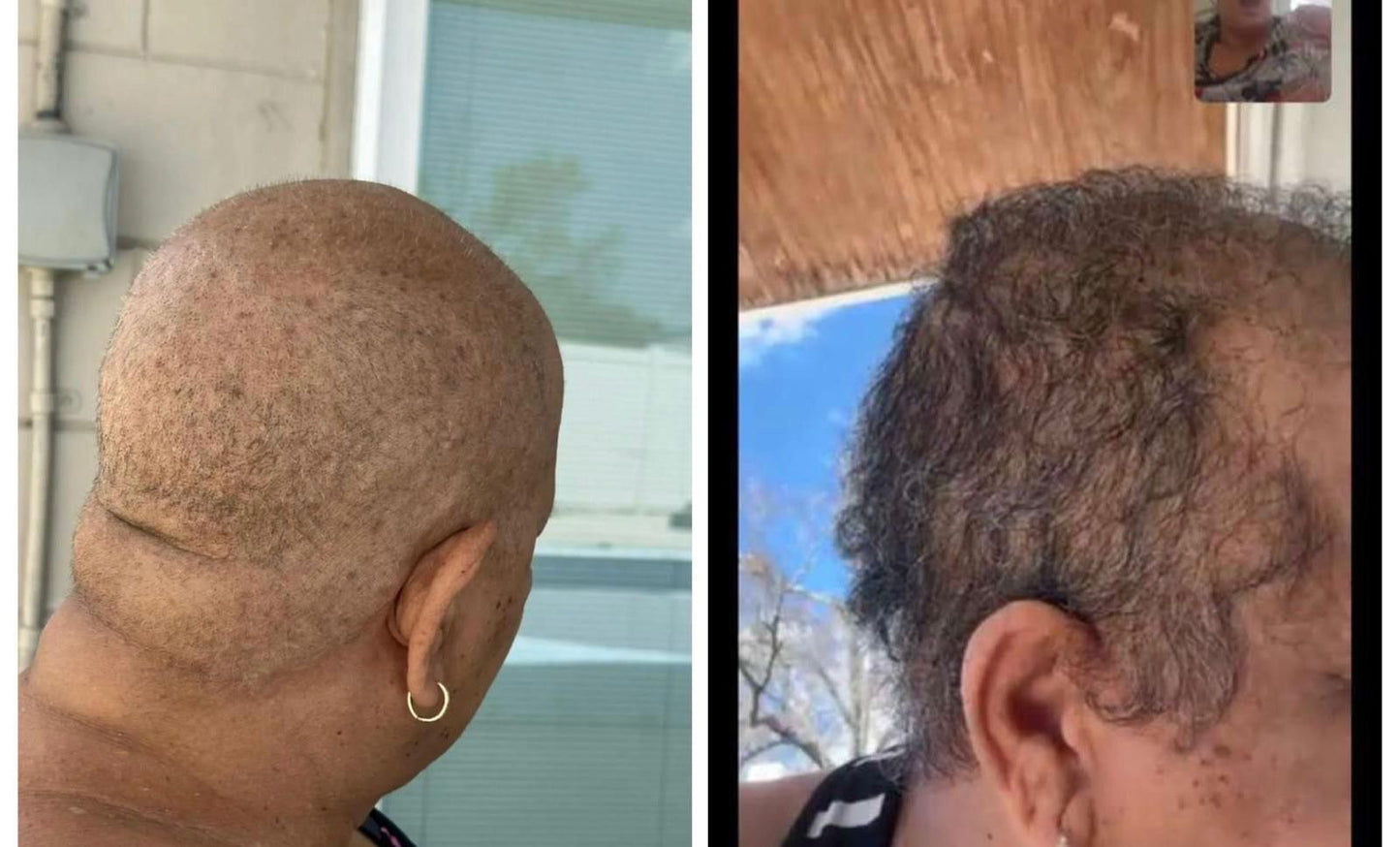 Fertilizante Folicular