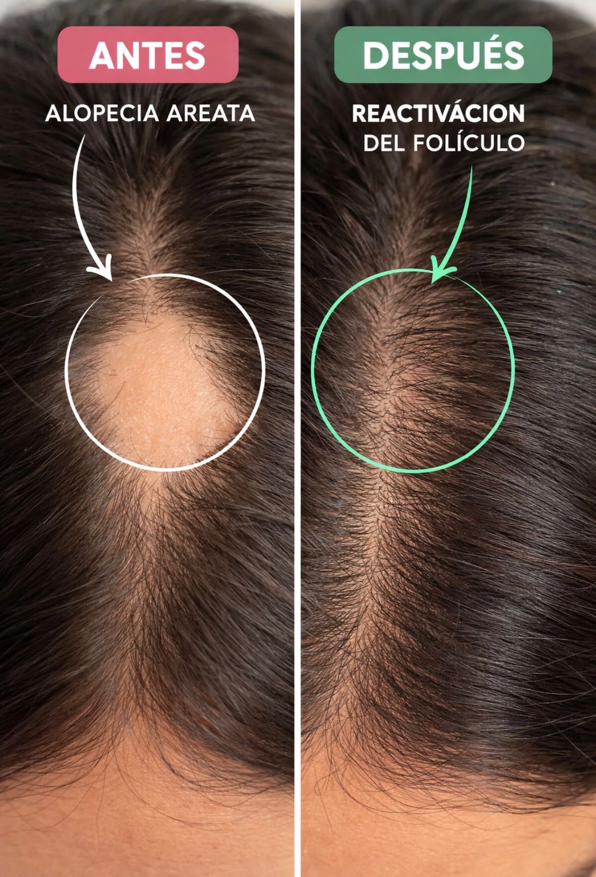Fertilizante Folicular