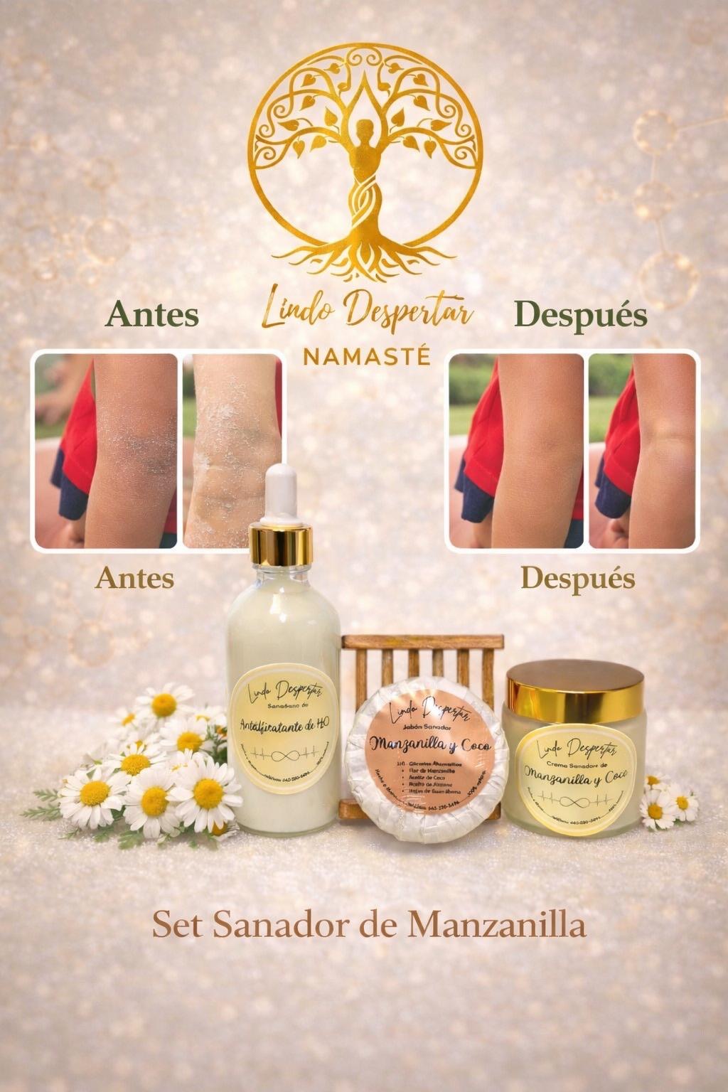 Set Sanador de Manzanilla