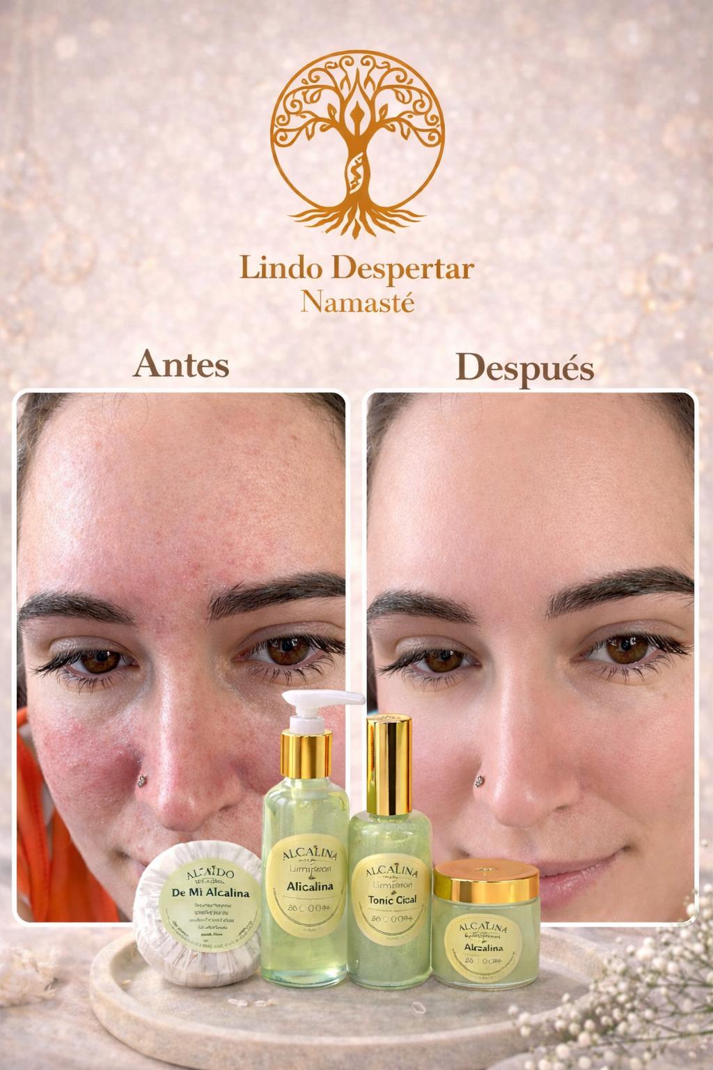 SKIN CARE Seborregulador