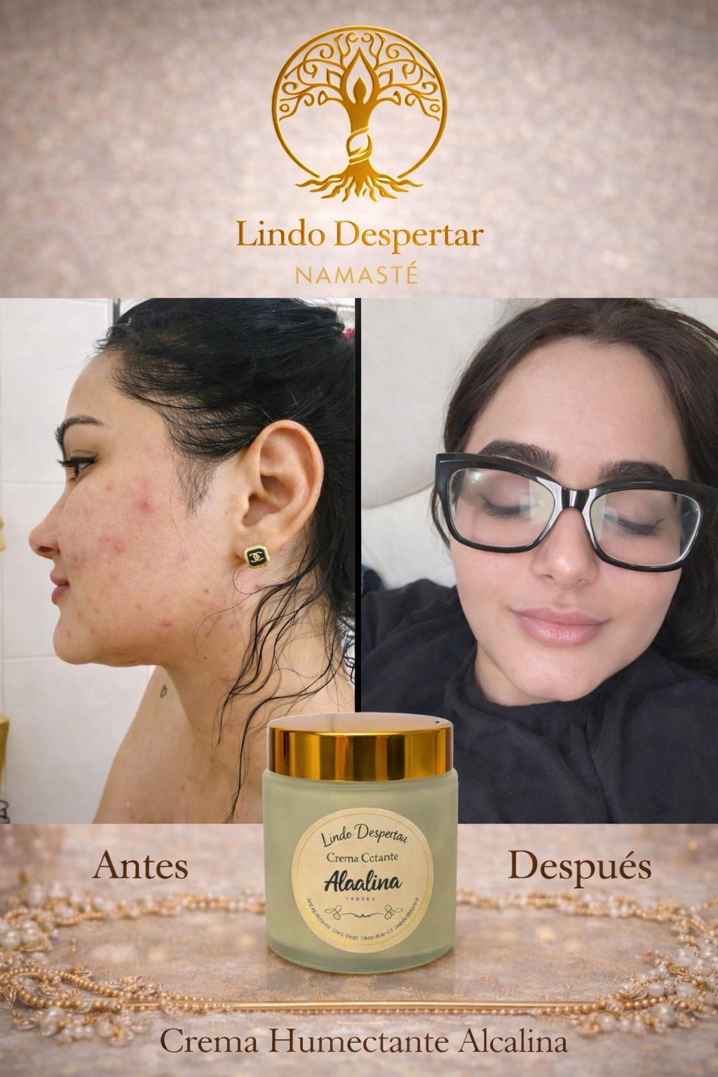 Crema Humectante Seborreguladora