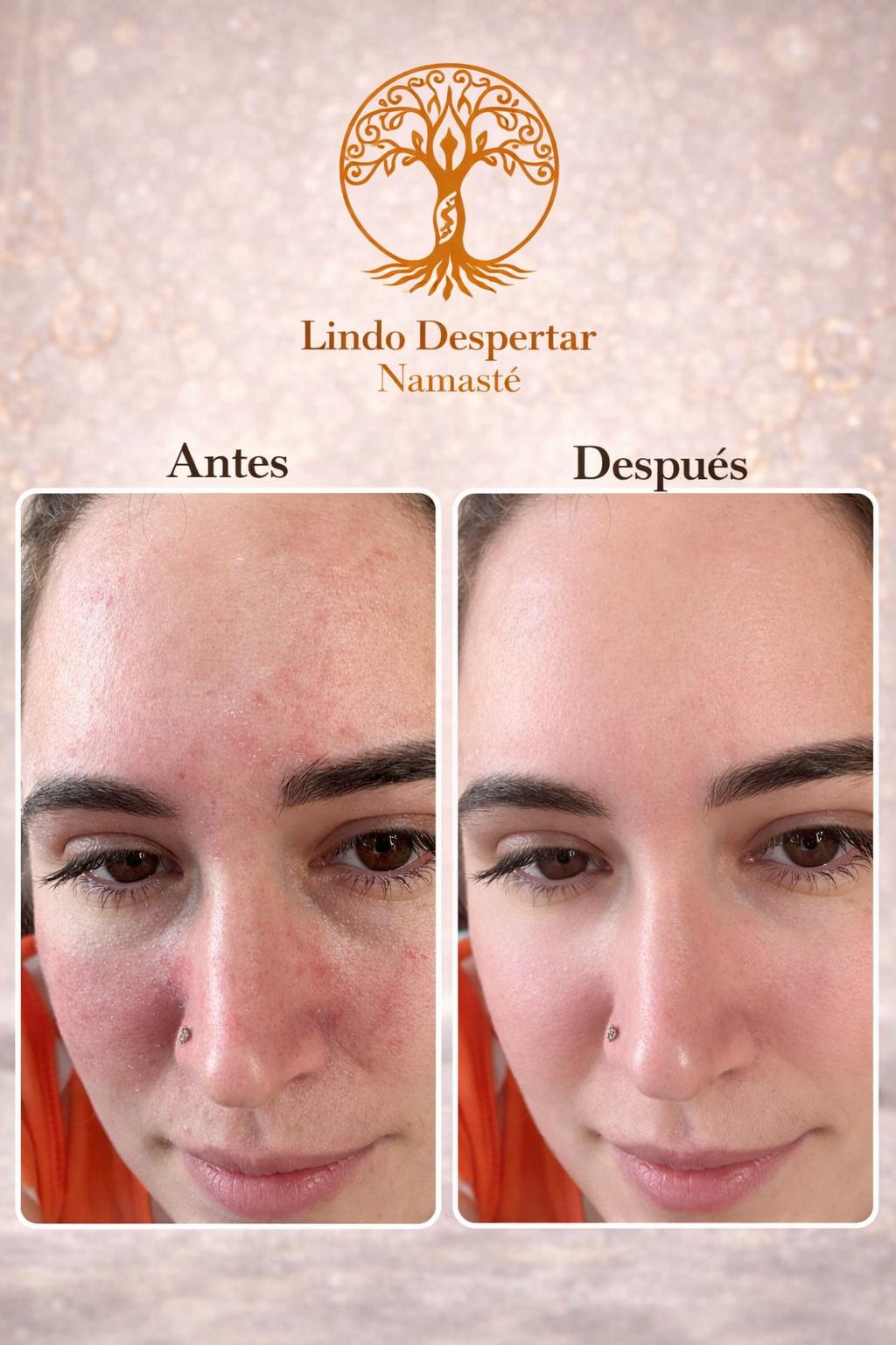 Crema Humectante Seborreguladora